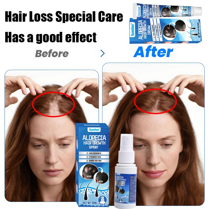 Sumifun Hair Growth Cream for Men & Women – Natural Hair Regrowth Treatment for Hair Loss, Thinning Hair & Scalp Repair