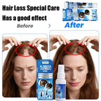 Sumifun Hair Growth Cream for Men & Women – Natural Hair Regrowth Treatment for Hair Loss, Thinning Hair & Scalp Repair