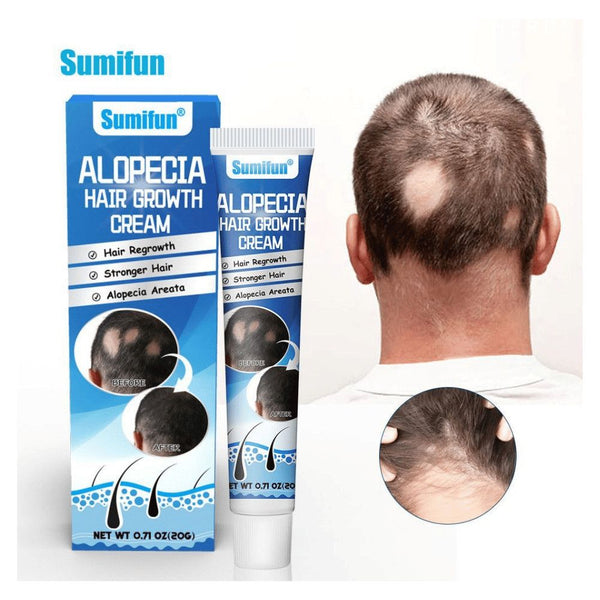 Sumifun Hair Growth Cream for Men & Women – Natural Hair Regrowth Treatment for Hair Loss, Thinning Hair & Scalp Repair