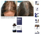 Hair Growth Spray